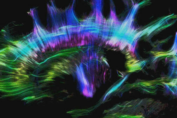 tractography_brain.jpg